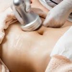 Lipocavitation&Radiofréquence