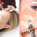 Microneedling&BBgllow